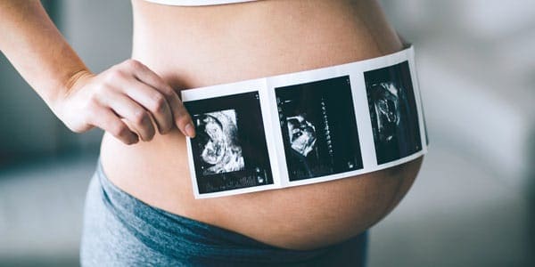 Pruebas geneticas en embarazadas