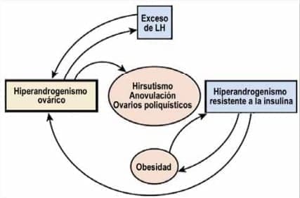 Hiperandrogenismo ovárico Hiperandrogenismo ovárico