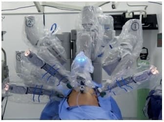 Gastrectomía asistida por robot Gastrectomía asistida por robot