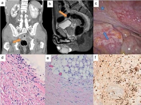 Imagen axial y sagital de resonancia nuclear Imagen axial y sagital de resonancia nuclear