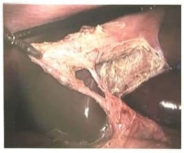 Visión crítica de seguridad Visión crítica de seguridad