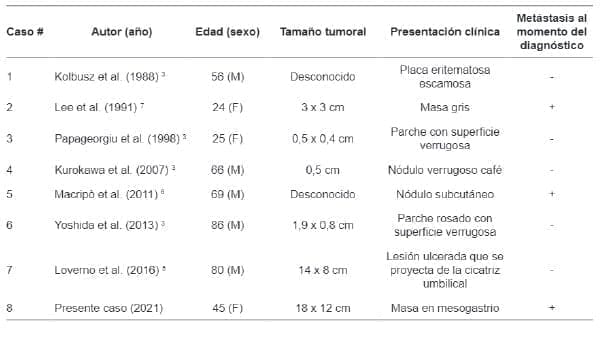Carcinoma escamocelular primario de ombligo Carcinoma escamocelular primario de ombligo