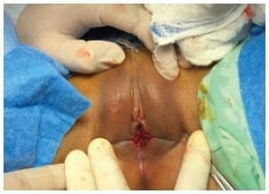 Técnica de Kelly Burnham Técnica de Kelly BurnhamTécnica de Kelly Burnham