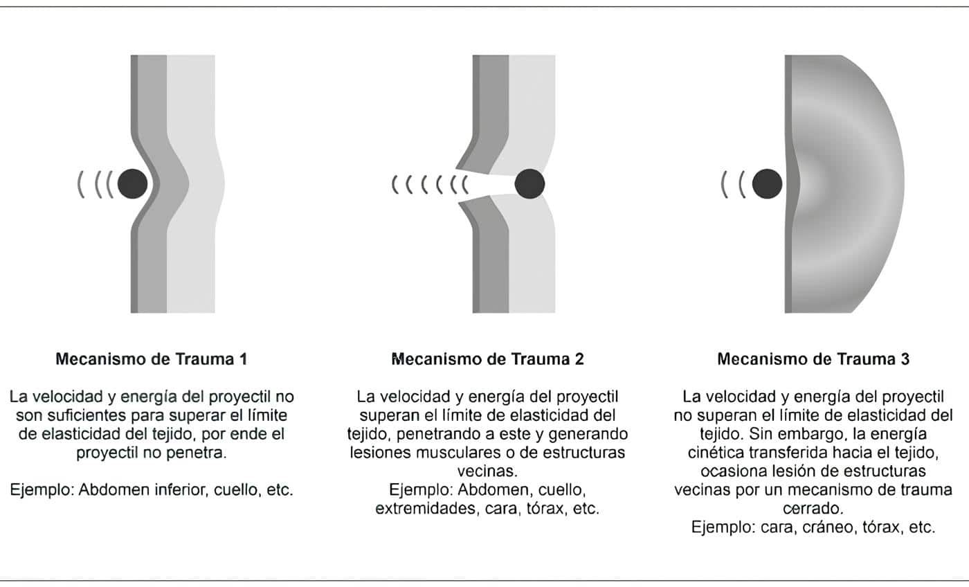 Posibles mecanismos de lesión tisular por proyectiles de armas 