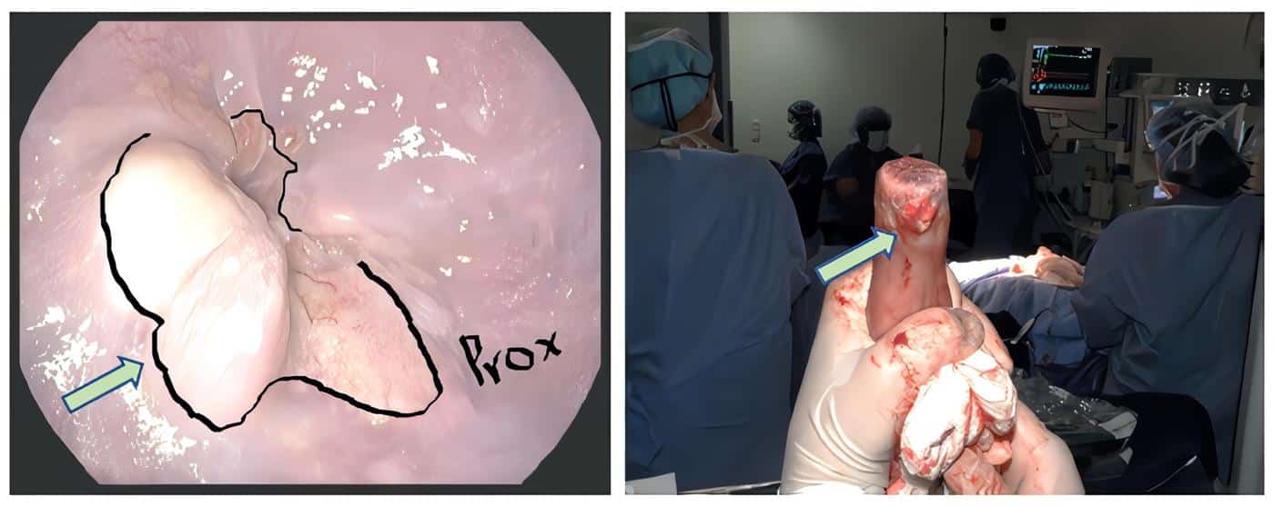 Imagen de correlación endoscópica y quirúrgica