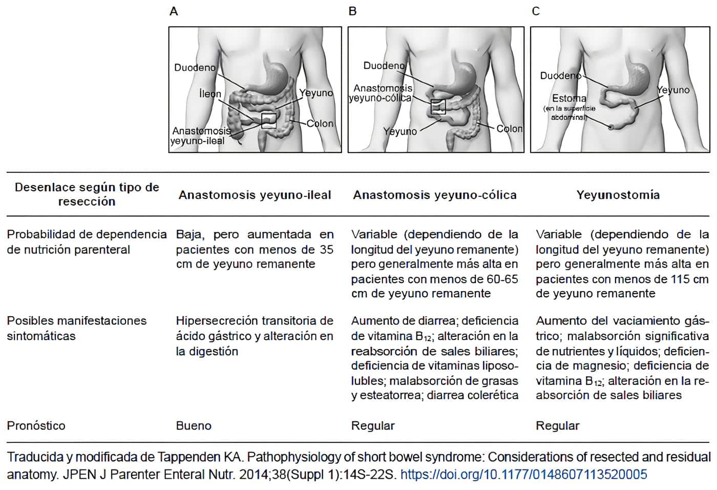 Tipos de resección intestinal y resultados asociados. Tipos de resección intestinal y resultados asociados.