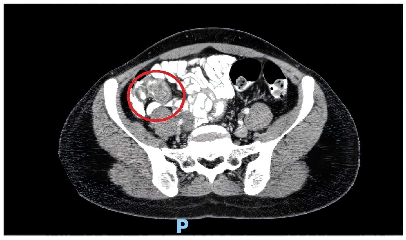 Signo de la doble diana