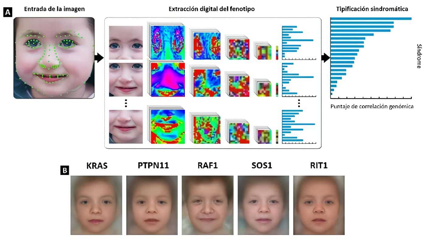 DeepGestalt, flujo de alto nivel - Intersección entre la Genómica y la IA DeepGestalt, flujo de alto nivel - Intersección entre la Genómica y la IA