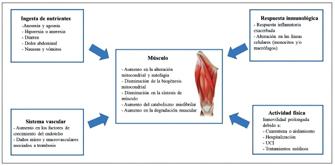 desarrollo de la sarcopenia en personas con síndrome poscovid-19. desarrollo de la sarcopenia
en personas con síndrome poscovid-19