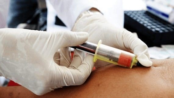 Analisis-de-Sangre-Diabetes-y-la-Enfermedad-Cardiaca-1.jpg
