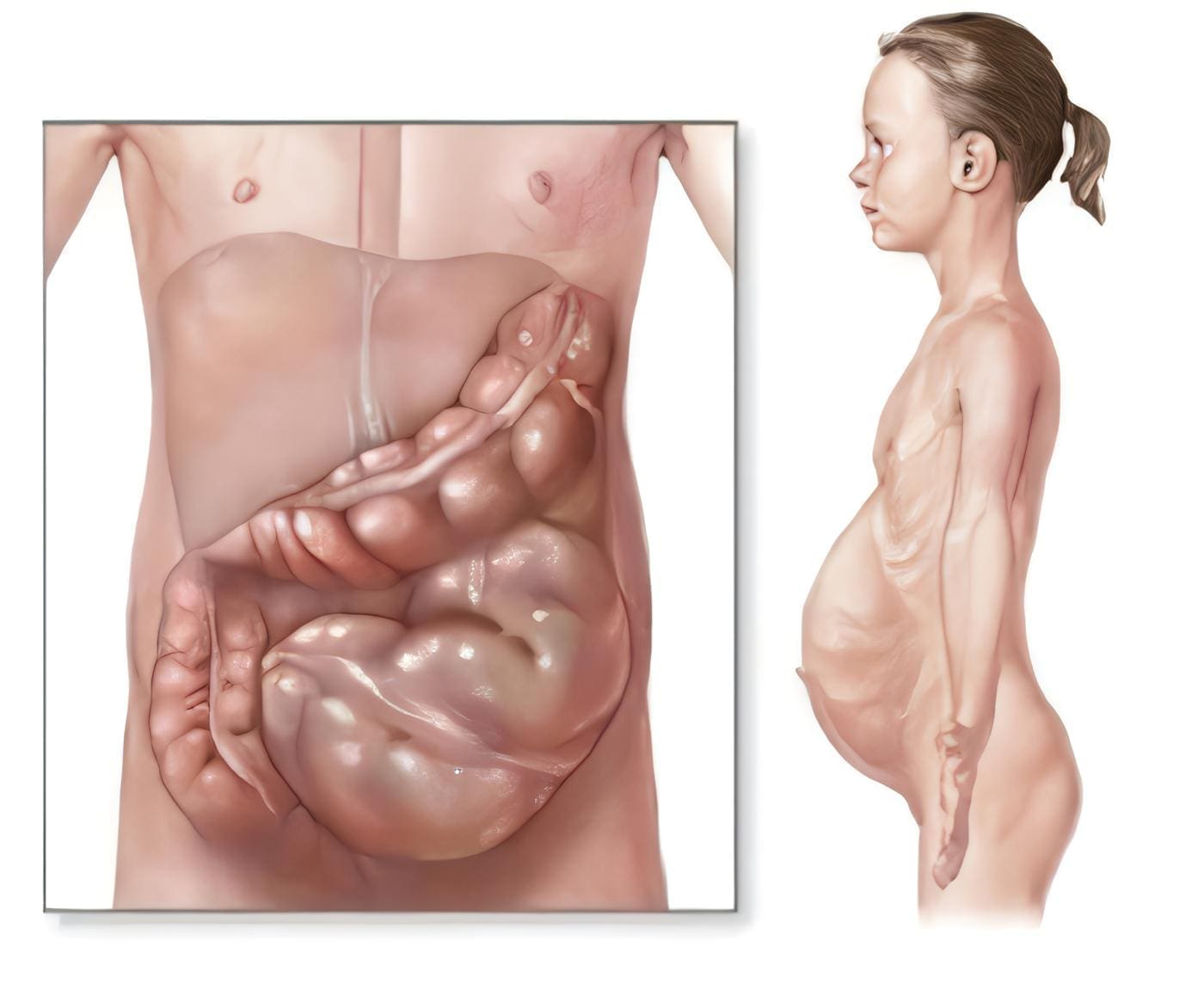embriologia-hirschsprung-1.jpg