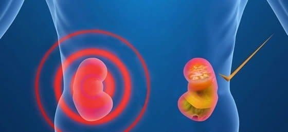 problemas-renales-hepaticos.jpg