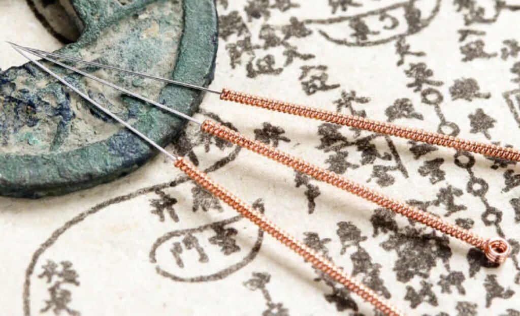 Acupuntura Japonesa: qué es, cómo funciona y por qué es diferente